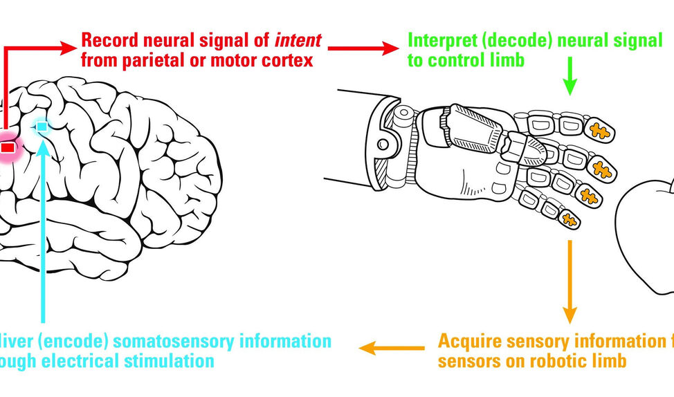 USC Researcher Leads First Team to Use Electrical Brain Stimulation to Produce Functional Sense of Touch 