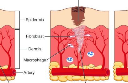 Scientist Breaks Through the Body’s Intricate Healing Process