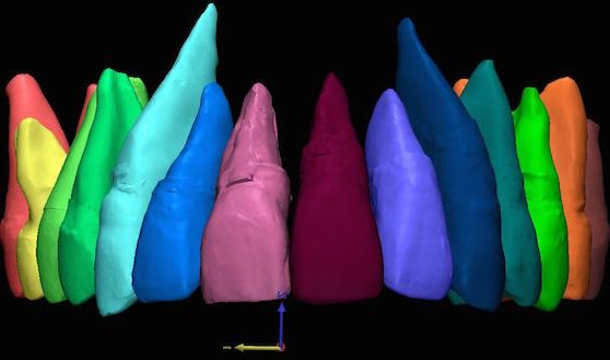 SC CTSI-Supported Research Finds a Better Way to Straighten Teeth