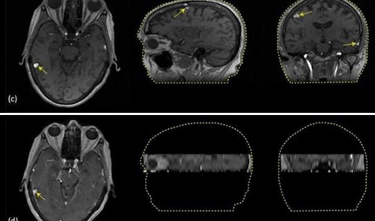 SC CTSI-Supported Researchers Create Higher Resolutions of the Brain