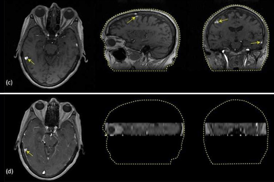 brain-MRI.jpg