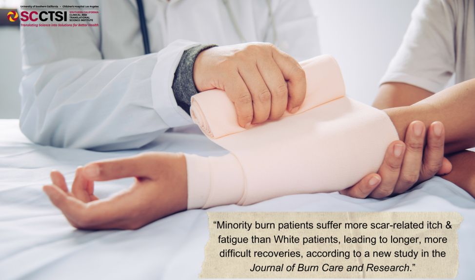 SC CTSI biostatistician provides critical contributions to study of burn patient recovery